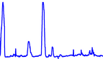 Electrodermal activity